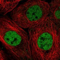 Anti-RBM7 antibody produced in rabbit 