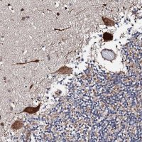 Anti-RCBTB2 antibody produced in rabbit HPA040242-100UL