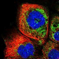 Anti-RDH13 antibody produced in rabbit 