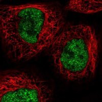 Anti-RECQL4 antibody produced in rabbit 