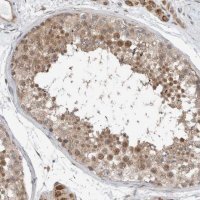 Anti-RERE antibody produced in rabbit 