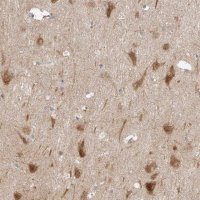 Anti-RERE antibody produced in rabbit 