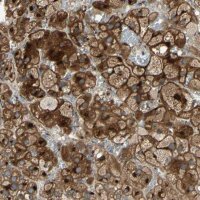 Anti-RET antibody produced in rabbit 
