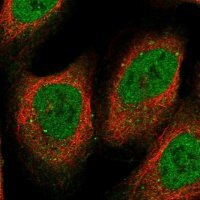 Anti-RFC5 antibody produced in rabbit 
