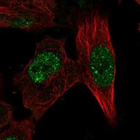 Anti-RFX8 antibody produced in rabbit 