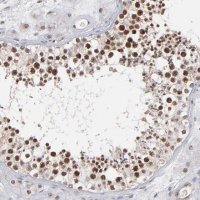 Anti-RGS6 antibody produced in rabbit 