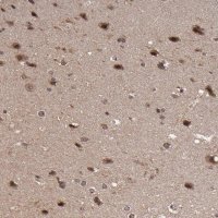 Anti-RGS6 antibody produced in rabbit 