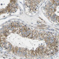 Anti-RHBDD1 antibody produced in rabbit 