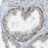 Anti-RHBDD1 antibody produced in rabbit 