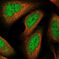 Anti-RHOBTB1 antibody produced in rabbit 