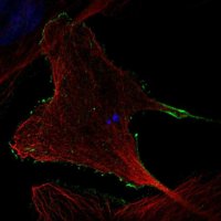 Anti-RHOBTB2 antibody produced in rabbit 