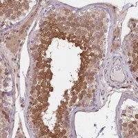 Anti-RIC8A antibody produced in rabbit 