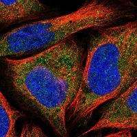 Anti-RIC8A antibody produced in rabbit 