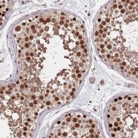 Anti-RIF1 antibody produced in rabbit 