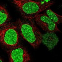 Anti-RIF1 antibody produced in rabbit 