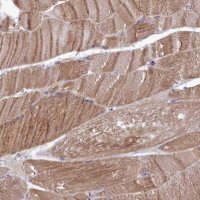 Anti-RILPL1 antibody produced in rabbit 