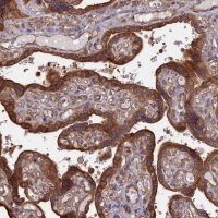 Anti-RILPL1 antibody produced in rabbit 
