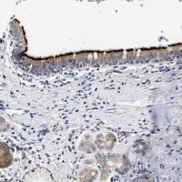 Anti-RINT1 antibody produced in rabbit HPA019875-100UL