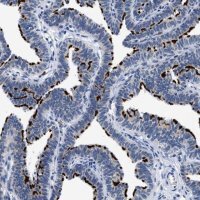 Anti-RINT1 antibody produced in rabbit HPA019875-100UL