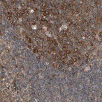 Anti-RIOK2 antibody produced in rabbit 
