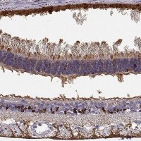 Anti-RLBP1 antibody produced in rabbit 