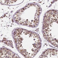 Anti-RMDN3 antibody produced in rabbit 