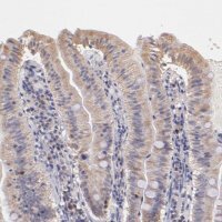 Anti-RNASEL antibody produced in rabbit 