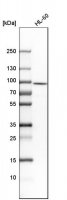 Anti-RNASEL antibody produced in rabbit 
