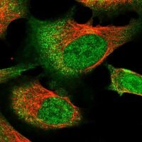 Anti-RNF111 antibody produced in rabbit