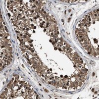 Anti-RNF114 antibody produced in rabbit 