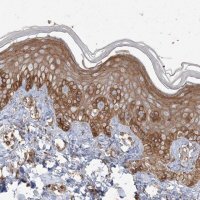 Anti-RNF145 antibody produced in rabbit 