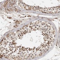 Anti-RNF157 antibody produced in rabbit