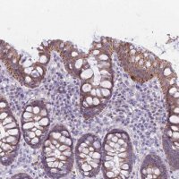 Anti-RNF170 antibody produced in rabbit 