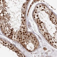 Anti-RNF187 antibody produced in rabbit 