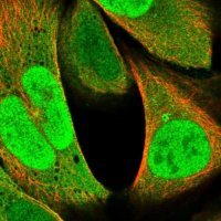 Anti-RNF187 antibody produced in rabbit 