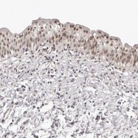 Anti-RNF2 antibody produced in rabbit 