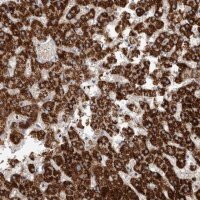 Anti-RNF217 antibody produced in rabbit HPA029598-100UL
