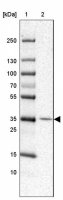 Anti-RNF217 antibody produced in rabbit HPA029598-100UL
