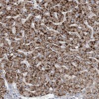 Anti-RNF25 antibody produced in rabbit 