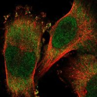 Anti-RNF25 antibody produced in rabbit 