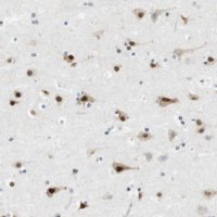 Anti-RNF38 antibody produced in rabbit 