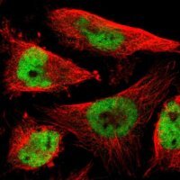Anti-RNF38 antibody produced in rabbit 