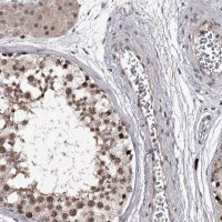 Anti-RNF44 antibody produced in rabbit 