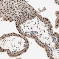 Anti-RNGTT antibody produced in rabbit 