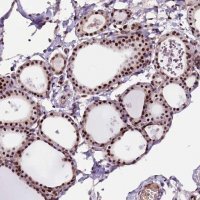 Anti-RNMT antibody produced in rabbit