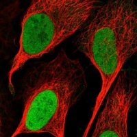 Anti-RNMT antibody produced in rabbit
