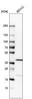 Anti-RP2 antibody produced in rabbit 