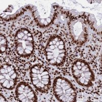 Anti-RPAP1 antibody produced in rabbit 