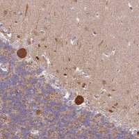 Anti-RPAP2 antibody produced in rabbit 