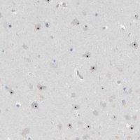 Anti-RPF1 antibody produced in rabbit 